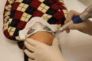 Détatouage médical - Le détatouage des sourcils au laser